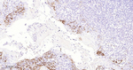 PD-L1 Antibody in Immunohistochemistry (Paraffin) (IHC (P))