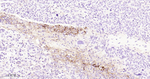 PD-L1 Antibody in Immunohistochemistry (Paraffin) (IHC (P))