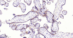 PD-L1 Antibody in Immunohistochemistry (Paraffin) (IHC (P))
