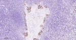 PD-L1 Antibody in Immunohistochemistry (Paraffin) (IHC (P))