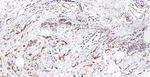 HLA-C Monoclonal Antibody (3C1-1A10)