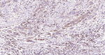 HLA-C Antibody in Immunohistochemistry (Paraffin) (IHC (P))