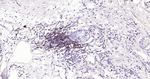 HLA-C Antibody in Immunohistochemistry (Paraffin) (IHC (P))