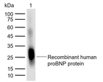 pro-Brain Natriuretic Peptide Monoclonal Antibody (7G11)