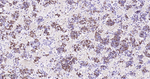 Prolactin Antibody in Immunohistochemistry (Paraffin) (IHC (P))
