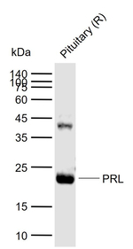 Prolactin Antibody in Western Blot (WB)
