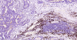 CD63 Antibody in Immunohistochemistry (Paraffin) (IHC (P))