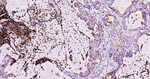 CD63 Antibody in Immunohistochemistry (Paraffin) (IHC (P))