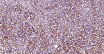 CD63 Antibody in Immunohistochemistry (Paraffin) (IHC (P))