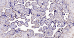 GC Antibody in Immunohistochemistry (Paraffin) (IHC (P))