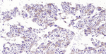 GC Monoclonal Antibody (5C1)