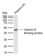 GC Antibody in Western Blot (WB)