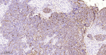 CA125 Antibody in Immunohistochemistry (Paraffin) (IHC (P))