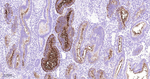 CA125 Antibody in Immunohistochemistry (Paraffin) (IHC (P))