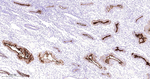 CA125 Antibody in Immunohistochemistry (Paraffin) (IHC (P))
