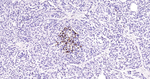 IGFBP3 Antibody in Immunohistochemistry (Paraffin) (IHC (P))