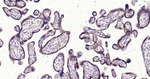 IGFBP3 Antibody in Immunohistochemistry (Paraffin) (IHC (P))