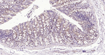 IGFBP3 Antibody in Immunohistochemistry (Paraffin) (IHC (P))