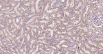 IGFBP3 Antibody in Immunohistochemistry (Paraffin) (IHC (P))