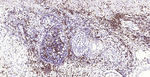 CEACAM5 Antibody in Immunohistochemistry (Paraffin) (IHC (P))