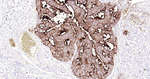 CEACAM5 Monoclonal Antibody (3C12)