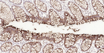 CEACAM5 Antibody in Immunohistochemistry (Paraffin) (IHC (P))