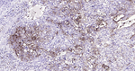CEACAM5 Antibody in Immunohistochemistry (Paraffin) (IHC (P))