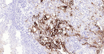 CEACAM5 Antibody in Immunohistochemistry (Paraffin) (IHC (P))