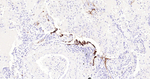 CEACAM5 Antibody in Immunohistochemistry (Paraffin) (IHC (P))