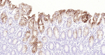 CEACAM5 Antibody in Immunohistochemistry (Paraffin) (IHC (P))