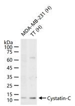 Cystatin C Monoclonal Antibody (9F11)