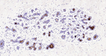 WFDC2 Antibody in Immunohistochemistry (Paraffin) (IHC (P))