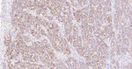 WFDC2 Antibody in Immunohistochemistry (Paraffin) (IHC (P))