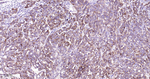 WFDC2 Antibody in Immunohistochemistry (Paraffin) (IHC (P))