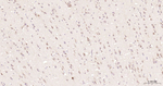 PR3 Recombinant Rabbit Monoclonal Antibody (1A4)