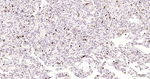PR3 Antibody in Immunohistochemistry (Paraffin) (IHC (P))