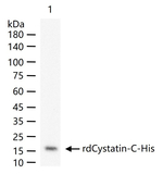 Cystatin C Monoclonal Antibody (8F11)