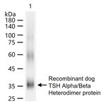 Thyroid Stimulating Hormone Monoclonal Antibody (13D8)