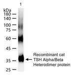 Thyroid Stimulating Hormone Monoclonal Antibody (8G1)
