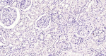 hCG beta Antibody in Immunohistochemistry (Paraffin) (IHC (P))