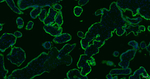 hCG beta Antibody in Immunohistochemistry (Paraffin) (IHC (P))