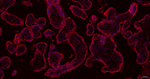 hCG beta Antibody in Immunohistochemistry (Paraffin) (IHC (P))