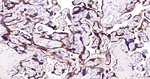 hCG beta Antibody in Immunohistochemistry (Paraffin) (IHC (P))