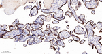 hCG beta Recombinant Rabbit Monoclonal Antibody (3F4)