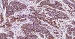SERPINB3 Antibody in Immunohistochemistry (Paraffin) (IHC (P))