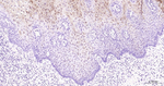 SERPINB3 Antibody in Immunohistochemistry (Paraffin) (IHC (P))