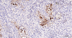 SERPINB3 Monoclonal Antibody (8C9)
