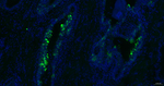 SERPINB3 Antibody in Immunohistochemistry (Paraffin) (IHC (P))