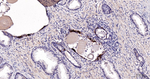 SERPINB3 Antibody in Immunohistochemistry (Paraffin) (IHC (P))