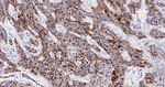 SERPINB3 Antibody in Immunohistochemistry (Paraffin) (IHC (P))